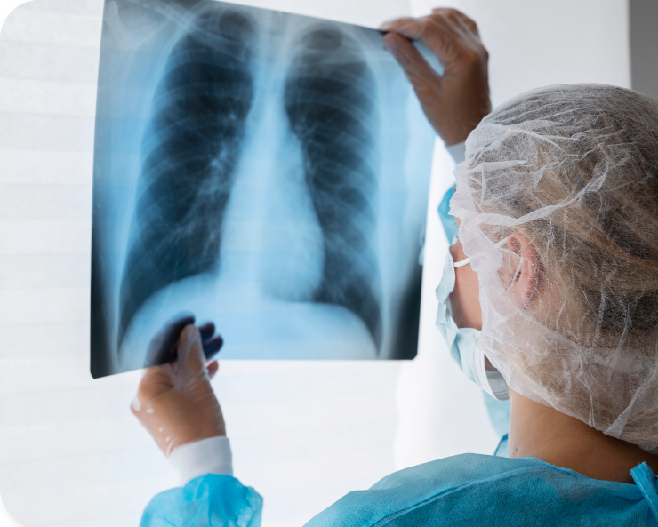 radiografia pulmonar